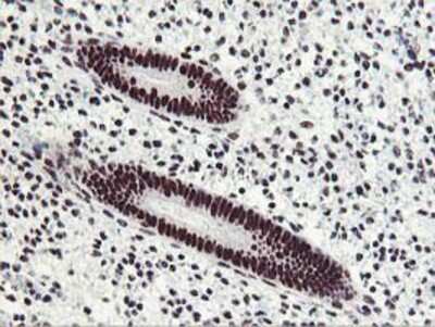 Immunohistochemistry-Paraffin: HOXC11 Antibody (OTI3E10) [NBP2-00499]