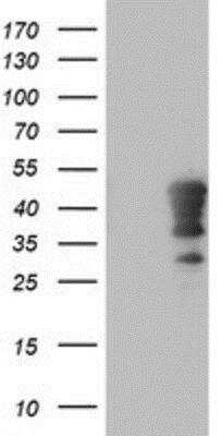 Western Blot: HOXC11 Antibody (OTI3E10) [NBP2-00499]