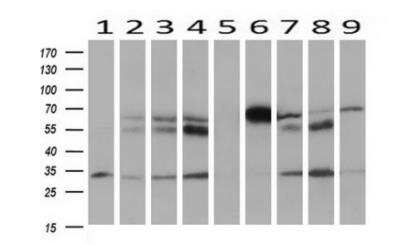 Western Blot: HOXC11 Antibody (OTI3E10) [NBP2-00499]