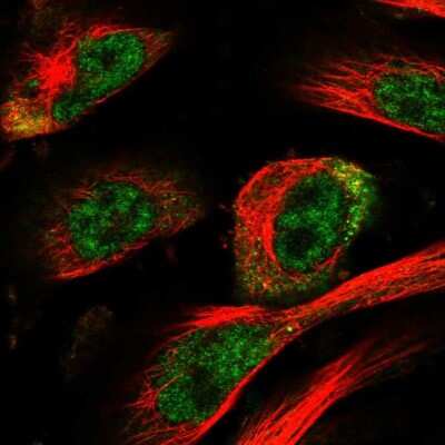 Immunocytochemistry/ Immunofluorescence: HOXC11 Antibody [NBP1-83230]