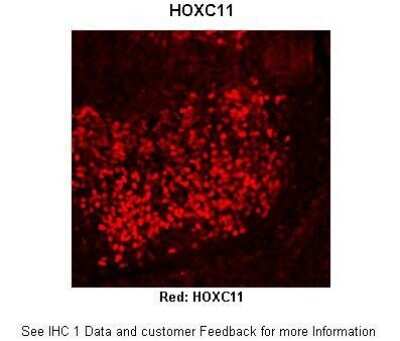 Immunohistochemistry: HOXC11 Antibody [NBP2-87592]