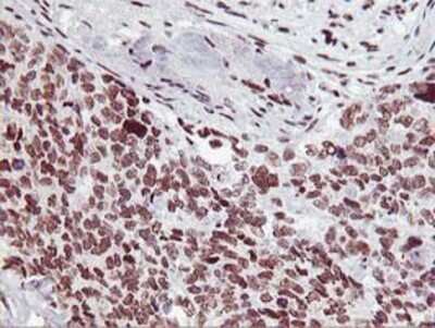 Immunohistochemistry: HOXC11 Antibody (OTI3E10) - Azide and BSA Free [NBP2-70913]