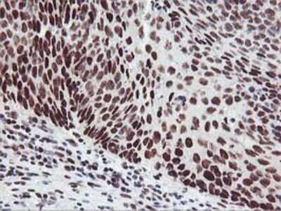 Immunohistochemistry: HOXC11 Antibody (OTI3E10) - Azide and BSA Free [NBP2-70913]