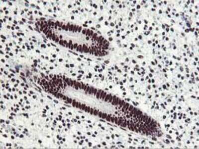 Immunohistochemistry: HOXC11 Antibody (OTI3E10) - Azide and BSA Free [NBP2-70913]