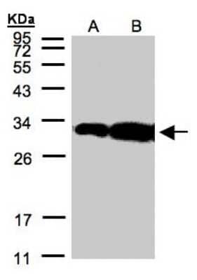 Western Blot: HOXC11 Antibody [NBP1-32331]