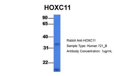 Western Blot: HOXC11 Antibody [NBP2-87591]