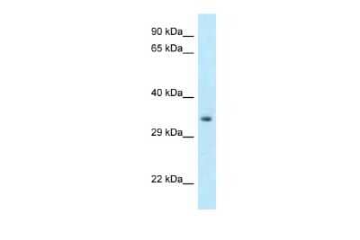 Western Blot: HOXC11 Antibody [NBP2-87593]