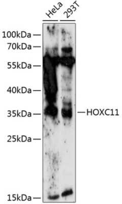 Western Blot: HOXC11 AntibodyAzide and BSA Free [NBP3-04552]