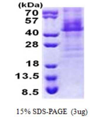 SDS-PAGE: Recombinant Human HOXC11 His Protein [NBP2-23126]