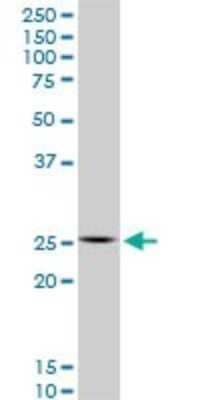 Western Blot: HOXC12 Antibody (1C6) [H00003228-M01]