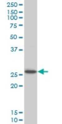 Western Blot: HOXC12 Antibody (1C6) [H00003228-M01]
