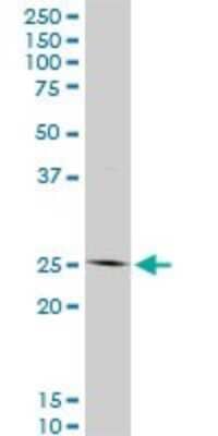 Western Blot: HOXC12 Antibody (1C6) [H00003228-M01]