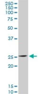 Western Blot: HOXC12 Antibody (2A4) [H00003228-M07]