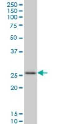 Western Blot: HOXC12 Antibody (2A4) [H00003228-M07]