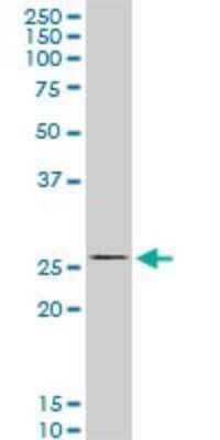 Western Blot: HOXC12 Antibody (2A4) [H00003228-M07]