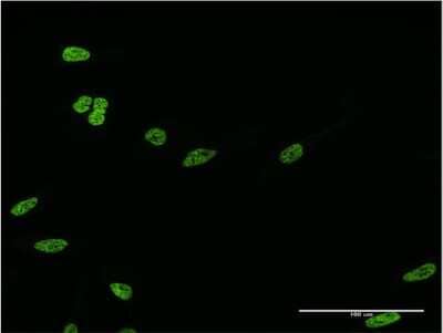 Immunocytochemistry/ Immunofluorescence: HOXC12 Antibody (3E1) [H00003228-M09]