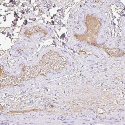 Immunohistochemistry: HOXC12 Antibody [NBP2-31608]