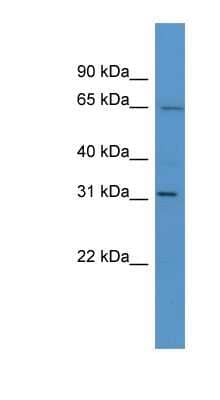 Western Blot: HOXC12 Antibody [NBP1-68929]