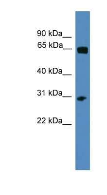 Western Blot: HOXC12 Antibody [NBP1-69214]