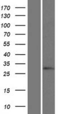 Western Blot: HOXC12 Overexpression Lysate [NBP2-05082]