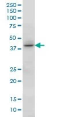 Western Blot: HOXC13 Antibody (10D4) [H00003229-M01]