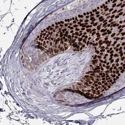 Immunohistochemistry-Paraffin: HOXC13 Antibody [NBP2-47428]