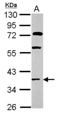 Western Blot: HOXC13 Antibody [NBP2-14987]