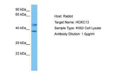 Western Blot: HOXC13 Antibody [NBP2-87595]