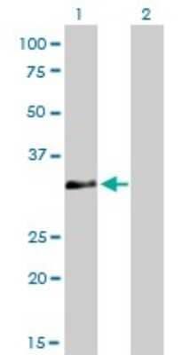 Western Blot: HOXC4 Antibody (1E9) [H00003221-M01]