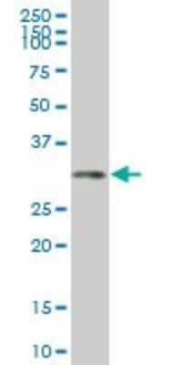 Western Blot: HOXC4 Antibody (2D6) [H00003221-M02]