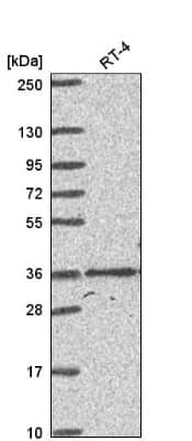 Western Blot: HOXC4 Antibody [NBP2-56195]