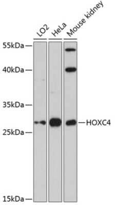 Western Blot: HOXC4 AntibodyAzide and BSA Free [NBP3-04943]