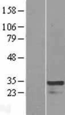 Western Blot: HOXC4 Overexpression Lysate [NBL1-11677]