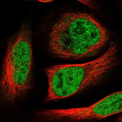 Immunocytochemistry/ Immunofluorescence: HOXC5 Antibody [NBP1-81718]