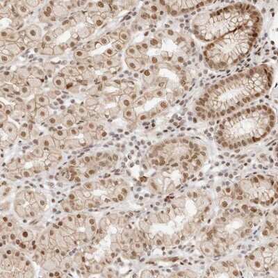 Immunohistochemistry-Paraffin: HOXC5 Antibody [NBP1-81718]