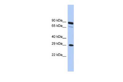 Western Blot: HOXC5 Antibody [NBP2-85064]