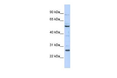 Western Blot: HOXC5 Antibody [NBP2-85065]