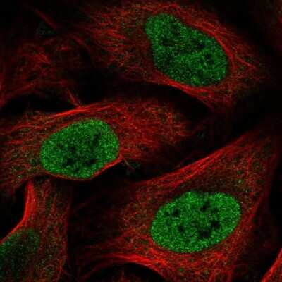 Immunocytochemistry/ Immunofluorescence: HOXC6 Antibody [NBP2-54948]