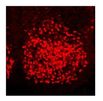 Immunohistochemistry: HOXC6 Antibody [NBP2-85069]