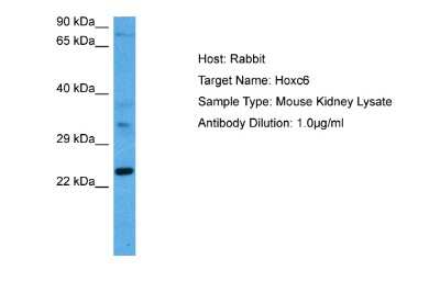 Western Blot: HOXC6 Antibody [NBP2-85070]