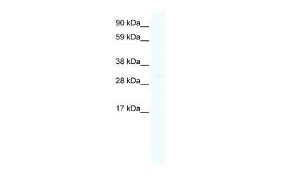 Western Blot: HOXC6 Antibody [NBP2-85071]