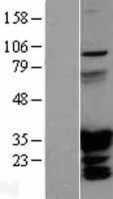 Western Blot: HOXC6 Overexpression Lysate [NBL1-11678]