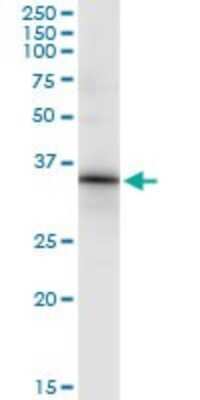 Immunoprecipitation: HOXC8 Antibody (1H2) [H00003224-M02]