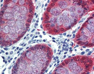 Immunohistochemistry-Paraffin: HOXC8 Antibody [NBP3-10513]