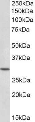 Western Blot: HOXC8 Antibody [NBP1-52085]