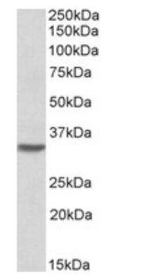 Western Blot: HOXC8 Antibody [NBP1-52085]