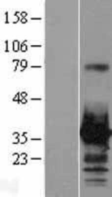 Western Blot: HOXC8 Overexpression Lysate [NBL1-11680]