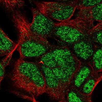 Immunocytochemistry/ Immunofluorescence: HOXC9 Antibody [NBP2-56557]