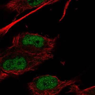 Immunocytochemistry/ Immunofluorescence: HOXC9 Antibody [NBP2-58032]