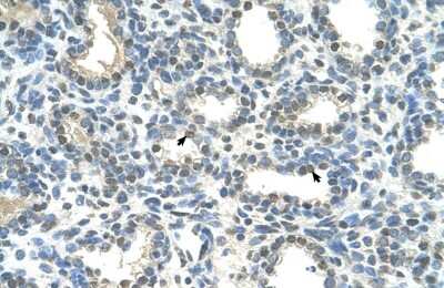 Immunohistochemistry: HOXC9 Antibody [NBP2-87596]